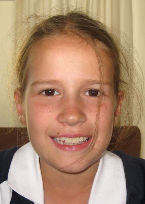 Lottie.