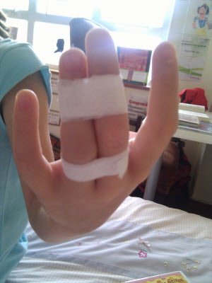 Lottie's broken finger.